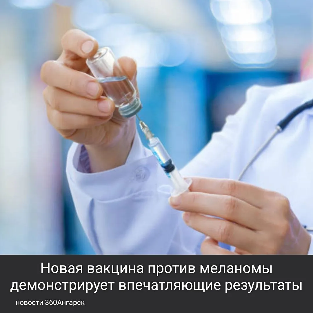 Российская вакцина, разработанная для борьбы с меланомой, показала эффективность более 90% в доклинических испытаниях на животных.