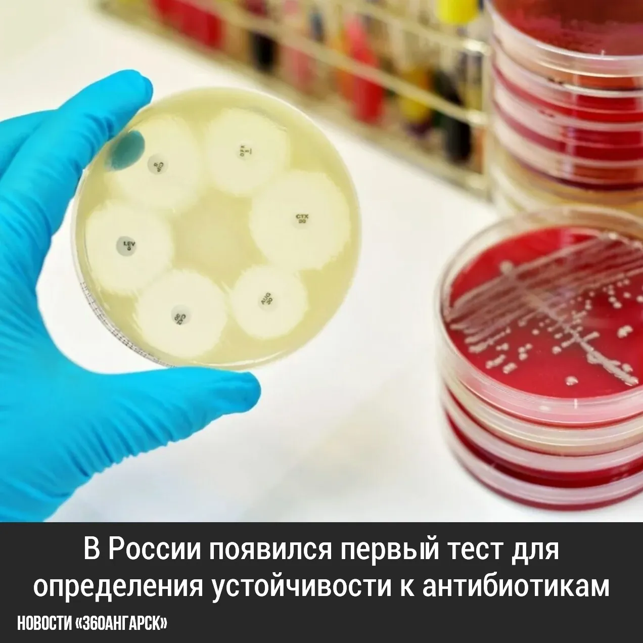 В России появился первый тест для определения устойчивости к антибиотикам!