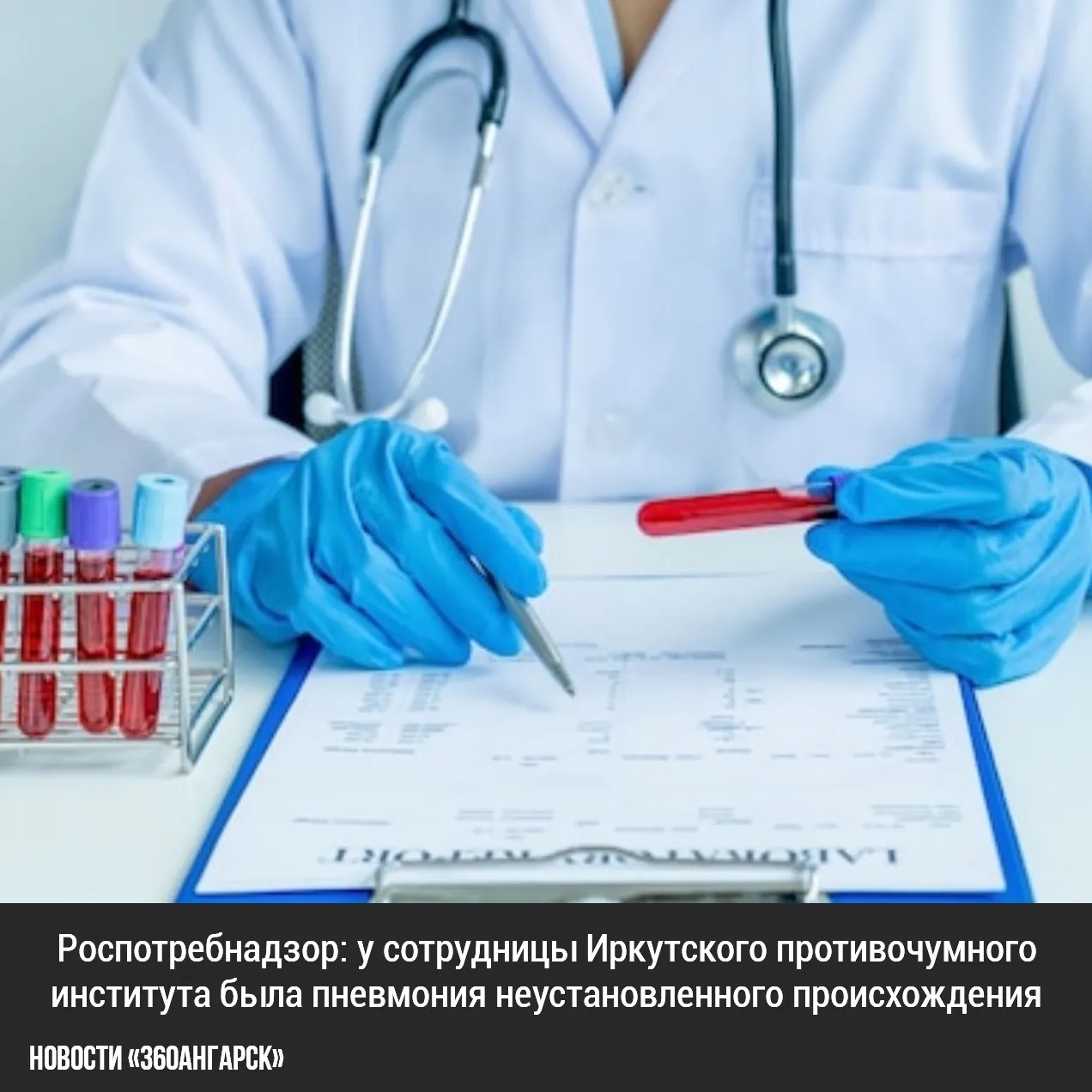 Роспотребнадзор: у сотрудницы Иркутского противочумного института была пневмония неустановленного происхождения